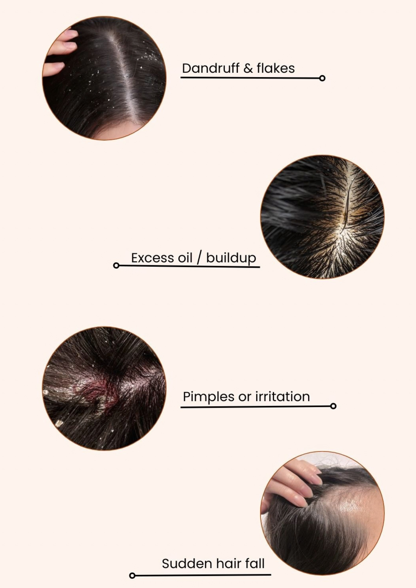 Dandruff treatment before and after